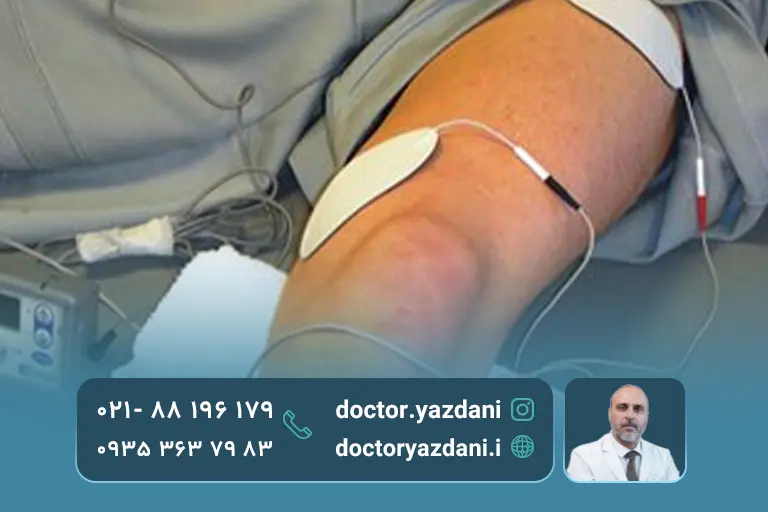 تحریک عضله چهارسر